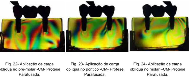 Fig. 22- Aplicação de carga  oblíqua no pré-molar -CM- Prótese 