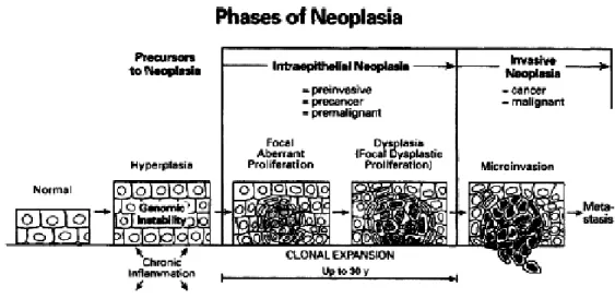 Figura 1: ilustração do começo e progressão da neoplasia de uma fase intraepitelial até uma fase invasiva (Go  et al., 2001)