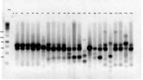 Figura 4 Eletroforese de gel de agarose 1,5% de produto de ERIC-PCR na presença  dos primers ERIC 1 e ERIC 2, utilizando o marcador de Gene Ruller 1KbDNA Ladder ≠  SM0311/2/3 - Fermentas