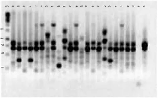 Figura 5 Eletroforese de gel de agarose 1,5% de produto de ERIC-PCR na presença  dos primers ERIC 1 e ERIC 2, utilizando o marcador de Gene Ruller 1KbDNA Ladder ≠  SM0311/2/3 - Fermentas