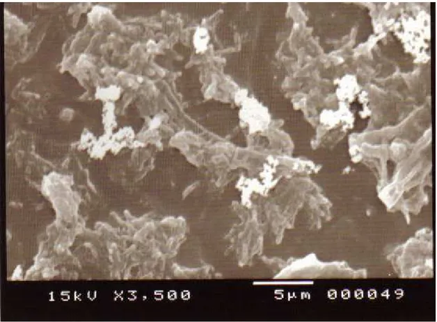 Figura 7: Eletromicrografia das linhas d'água de equipamento odontológico. matrizes  densas e extensas de substâncias poliméricas extracelulares
