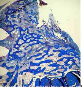 FIGURA 17a – Grupo IV, (Quitosana) 15 dias. Aumento de 40x. Trabéculas ósseas em  formação, entremeadas com tecido conjuntivo vascularizado