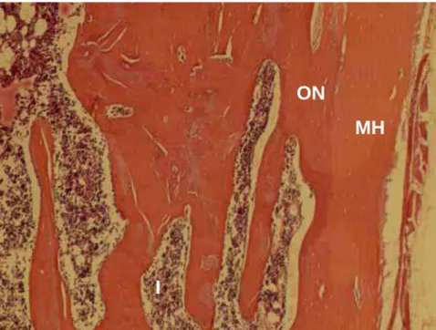 Figura 9 – ICMH60 – Superficialmente, a membrana homógena (MH)  recobre a ferida e é incorporada ao osso neoformado (ON)