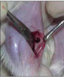 Figura 21 – Tíbia esquerda preenchida            Figura 22 – Membrana na posição/sutura 
