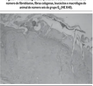 Figura 1 - Foto histológica exemplificando o exame morfométrico do número de fibroblastos, fibras colágenas, leucócitos e macrófagos do