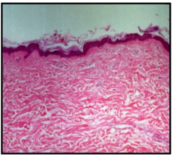 Figura 2: Foto mostrando corte histológico da pele humana,  enfocando a epiderme queratinizada e a derme (HE  40X)