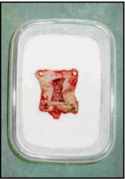 Figura 13: Peça espraiada e  fixada na placa de isopor dentro de  recipiente plástico
