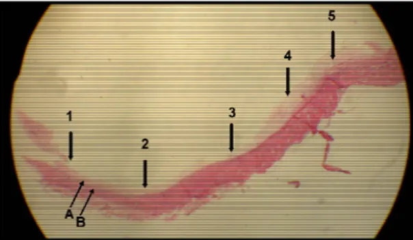 Figura 15: Foto histológica exemplificando os pontos em que foram  realizados o exame histológico e morfométrico da área  cruenta (HE X10)