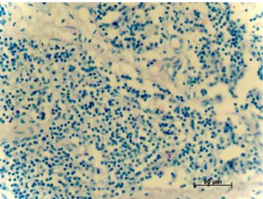 FIGURA 3. Bacilos ácido-álcool-resistentes observados em linfonodos de  bovinos naturalmente infectados por Mycobacterium sp