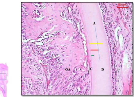 Fig.  5  -  Representação  microscópica  da  profundidade  da  reabsorção  radicular.  Linha  azul  (linha  A)  representa  metade  da  espessura  da  dentina;  escore  4  -  linha  amarela;  escore  3  -  linha  vermelha;  escore  2  -  linha  verde
