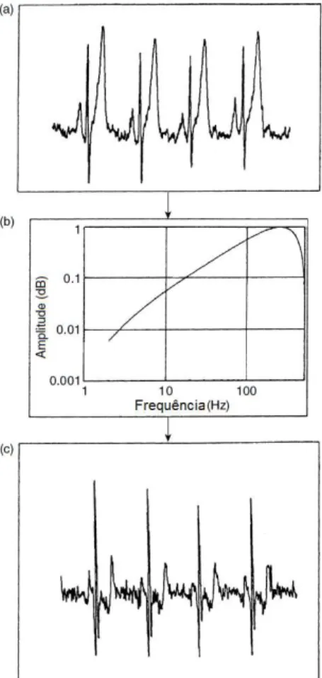 Figura 2.8 – Efeito de um filtro passa-alto (b) num sinal de ECG (a). Sa´ıda do sinal ap´ os aplica¸c˜ ao do filtro representado em (c)