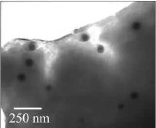 Figura 1. Amostra 5 (correspondente a um líquido sinovial com cristais de cálcio identificados em microscopia de luz polarizada) – Cristais contendo cálcio e fósforo (detectados em espectroscopia de dispersão de energia) visualizados em microscopia electró