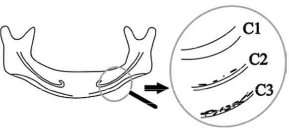 Figura  2-  Desenho  esquemático  da  classificação  qualitativa  da  cortical  mandibular  (C)  em  radiografia  panorâmica  de  mulheres  pós-menopausa