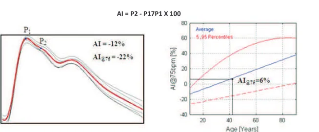 Figura 6. Esquema representativo do  índice de aumento  (AI) calculado a partir do sinal do EndoPAT: representa  o quociente entre a variação do pico de pressão sistólica tardia (P2) pelo pico de pressão sistólica precoce (P1)   e este valor
