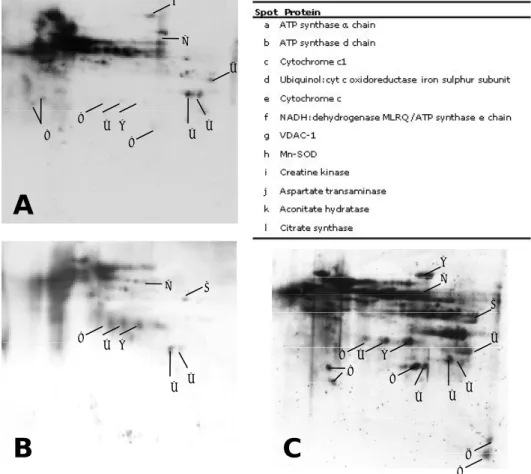 Figure II.4 – Representative 2-DE oxyblots of each group and identification of the most  significant carbonylated proteins; A – young mice, B – non-sedentary mice, C – sedentary mice;  
