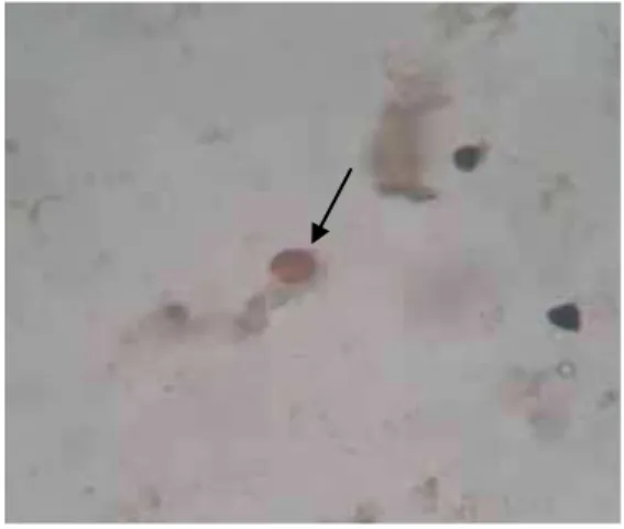 Figura 2. Ovo de Ascaris lumbricoides (fecundado) 