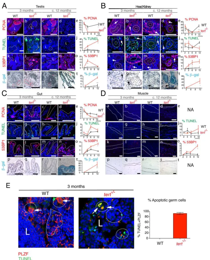 Figure 4. Proliferative tissue degeneration is accompanied by a sustained decrease in proliferation, acute apoptotic responses, and progressive accumulation of DDR foci