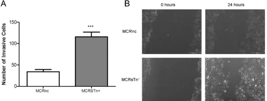Figure 8 e STn expression promotes MCR cells wound healing closure and invasion. A) Wound healing closure assay