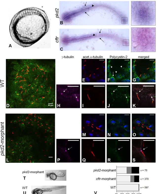 Fig. 1. Polycystin-2 and CFTR expression. (A) Localization of KV (squared region) in the body of a 10–11 s.s