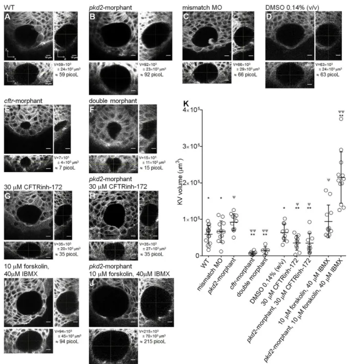 Fig. 2. KV volume. (A-J) Confocal live-microscopy scans of the whole KV of 10–11 s.s. ras:GFP transgenic embryos