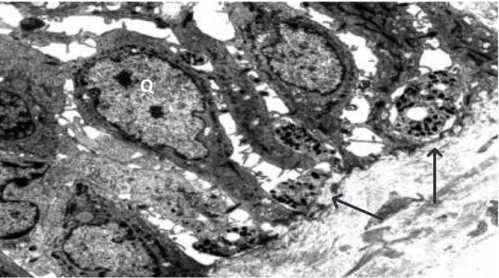 Fig. 24  - Microscopia electrónica de transmissão 2500X. Corda vocal humana. Camada basal  