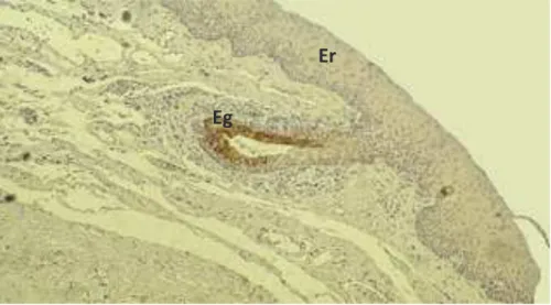 Fig. 36  - Microscopia óptica Imuno-citoquímica 35βE12 120X. Corda vocal humana. Observa-se epitélio  de revestimento (Er) não marcado com o anticorpo anti citoqueratina de baixo peso molecular que só  marca o epitélio glandular (Eg).