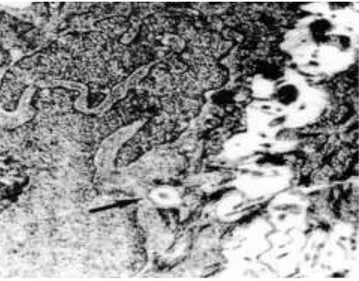 Fig. 16  - Microscopia electrónica de transmissão 4800X. Mucosa oral humana. Observa-se esporão   de célula de Merkel cortado transversalmente (seta).
