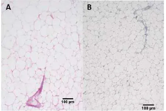 Figura 26: Secção histológica comparando tecido adiposo de Prochilodus  lineatus (corimbatá) coletado no mês agosto de 2011