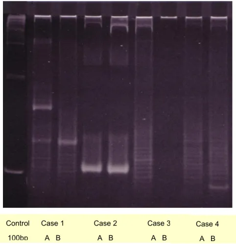Figure 2.1 - Agarose PCR of four paired samples showing clonal relation. 