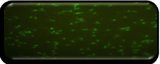 Figura  2.6.  Exemplo de um resultado reactivo do FTA-Abs  à observação microscópia  de fluorescência