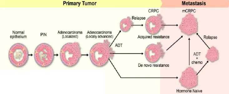 Figura 10. Progressão do cancro da próstata e desenvolvimento de cancro prostático resistentes