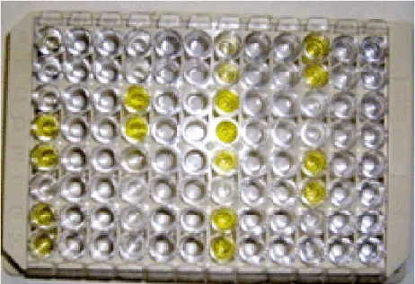 Figura 3. Teste Imunoenzimático. Exemplo de uma microplaca com 96 poços (poços  com coloração amarela correspondem a amostras positivas; poços incolores correspondem a 