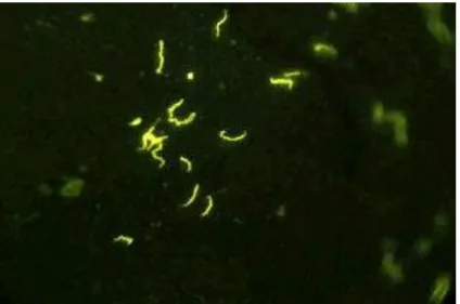 Figura 4. Teste de Imunofluorescência indirecta. Exemplo de uma amostra positiva  evidenciando a espiroqueta Treponema pallidum fluorescente