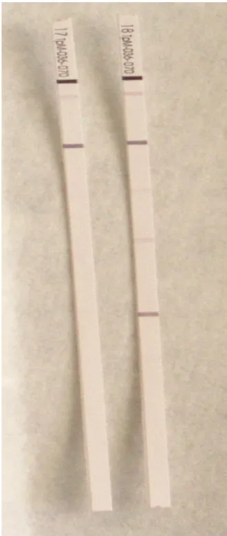 Figura 5. Teste Western-blot. Exemplo de duas tiras de membrana de nitrocelulose  sensibilizadas com as proteínas TpN47; TmpA; TpN17 e TpN15 de Treponema  pallidum (tira esquerda  –  exemplo de amostra negativa; tira direita  –  exemplo de 