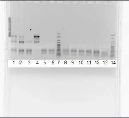 Figura 6.  Visualização, após electroforese em gel de agarose dos produtos  amplificados pela técnica de PCR-Multiplex