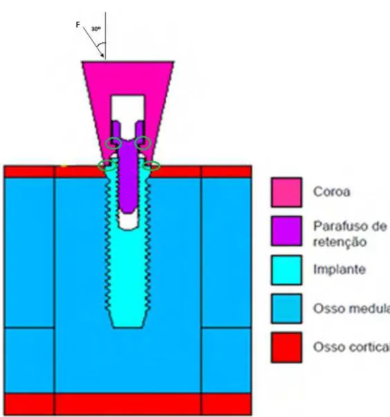 Figura 1.1 – Modelo biomecânico com áreas de contato em destaque, bem como  a força de mastigação