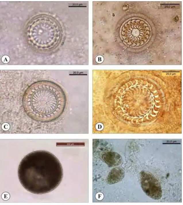 Figura 3. Protozoários encontrados em tilápias do Nilo (Oreochromis niloticus),  provenientes de cultivo em tanques-rede no rio Grande, reservatório de Água Vermelha,  Estado de São Paulo, Brasil