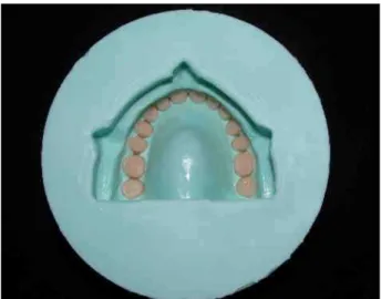 FIGURA 1 - Dentes posicionados no interior do molde.