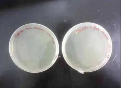 FIGURA 2 – Placas semeadas com RPMI+glicose após 24h  de contato com o sabonete comum sem uso