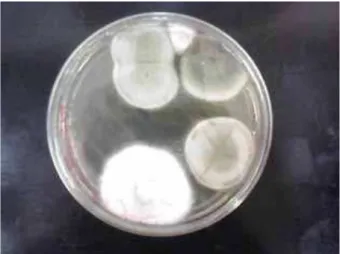 FIGURA 5 – Placa semeada com RPMI+glicose  usado na lavagem da saboneteira do sabonete  anti-séptico após uma semana de uso