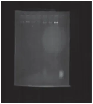 FIGURA 10 – Gel de PCR com bandas  evidenciando presença de material genético  purificado