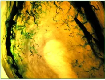 Fig. 60 - Artérias arqueadas uterinas humanas e seus ramos de divisão, observados à lupa estereoscópica,  em corte transversal de corpo uterino, após injecção vascular de Micropaque®, diafanização e transiluminação