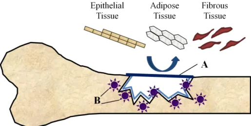 Figure 1 – Schematic representation of GBR principals. The occlusive membrane must face the bone surface and  support a mechanical exclusion of undesirable soft tissues from growing into the osseous defect