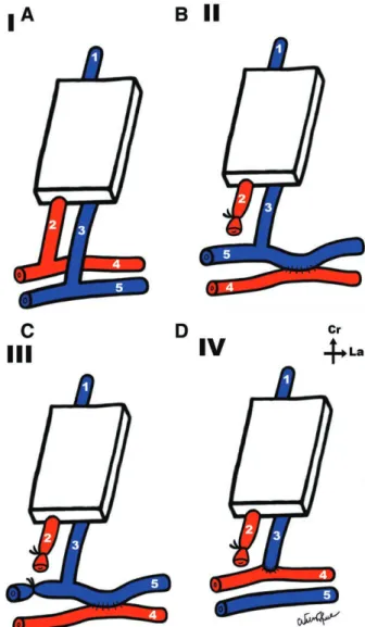 Fig. 2. a,B,C,D, Schematic representation of the vascular patterns  in the different experimental groups
