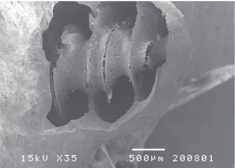 FIG. 14  Microscopia electrónica de varrimento -corrosão incompleta e