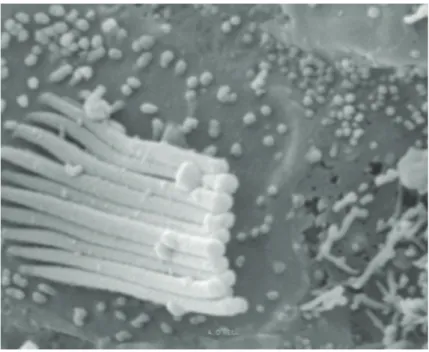FIG. 24  Microscopia electrónica de varrimento — 10 000×.