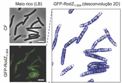 Figura 3 – RodZ forma padrão em bandas ao longo do eixo longitudinal da célula. Imagens de  contraste de fase (CF), de fluorescência e de desconvolução 2D (RodZ, corado artificialmente de azul)  de células vegetativas de  B