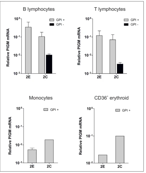 Fig.  19  -  PIGM  mRNA  expression  in  haematopoietic  cells  isolated  from  PBMC  of  individuals from Family 2