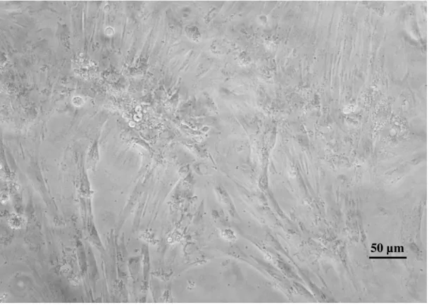 Figura 9: Foto de fibroblastos tirada por máquina digital (zoom 2,9) em microscópio invertido modelo Telaval 31,  fabricante Carl Zeiss, em aumento de 30x
