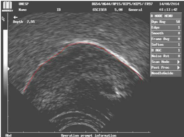Figura 3: Imagem capturada de ultrassom corresponde à fase 1 da  visualização ultrassonográfica da deglutição orofaríngea em corte sagital